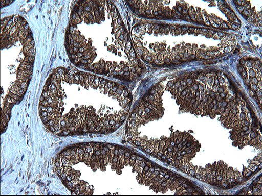 FNDC8 Antibody - IHC of paraffin-embedded Human prostate tissue using anti-FNDC8 mouse monoclonal antibody. (Heat-induced epitope retrieval by 1 mM EDTA in 10mM Tris, pH8.5, 120°C for 3min).
