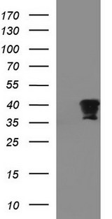 FNDC8 Antibody - HEK293T cells were transfected with the pCMV6-ENTRY control (Left lane) or pCMV6-ENTRY FNDC8 (Right lane) cDNA for 48 hrs and lysed. Equivalent amounts of cell lysates (5 ug per lane) were separated by SDS-PAGE and immunoblotted with anti-FNDC8.