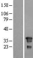 FNDC8 Protein - Western validation with an anti-DDK antibody * L: Control HEK293 lysate R: Over-expression lysate