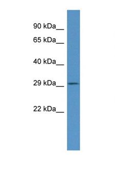 FNDC9 Antibody - C030019I05Rik antibody Western blot of Mouse Thymus lysate. Antibody concentration 1 ug/ml.  This image was taken for the unconjugated form of this product. Other forms have not been tested.