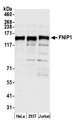 FNIP1 Antibody - Detection of human FNIP1 by western blot. Samples: Whole cell lysate (50 µg) from HeLa, HEK293T, and Jurkat cells prepared using NETN lysis buffer. Antibody: Affinity purified rabbit anti-FNIP1 antibody used for WB at 1:1000. Detection: Chemiluminescence with an exposure time of 30 seconds.