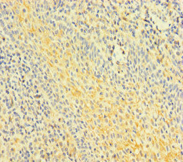 FNIP1 Antibody - Immunohistochemistry of paraffin-embedded human tonsil tissue at dilution of 1:100