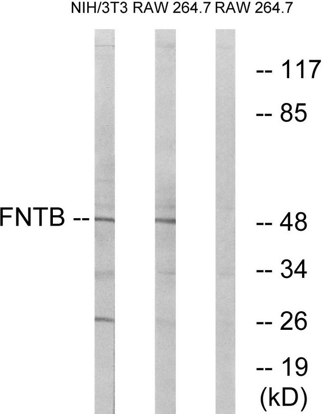 FNTB Antibody - Western blot analysis of lysates from RAW264.7 abd NIH/3T3 cells, using FNTB Antibody. The lane on the right is blocked with the synthesized peptide.