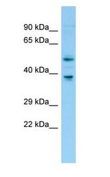FNTB Antibody - FNTB antibody Western Blot of Rat Thymus.  This image was taken for the unconjugated form of this product. Other forms have not been tested.