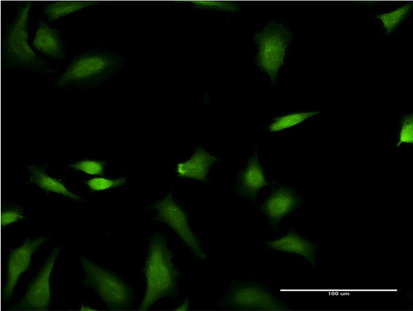 FNTB Antibody - Immunofluorescence of monoclonal antibody to FNTB on HeLa cell . [antibody concentration 10 ug/ml]