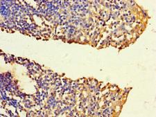 FNTB Antibody - Immunohistochemistry of paraffin-embedded human tonsil tissue using FNTB Antibody at dilution of 1:100