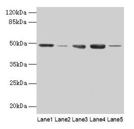 FNTB Antibody - Western blot All lanes: FNTB antibody at 6µg/ml Lane 1: Hela whole cell lysate Lane 2: CEM whole cell lysate Lane 3: HepG2 whole cell lysate Lane 4: SH-SY5Y whole cell lysate Lane 5: U87 whole cell lysate Lane 6: A375 whole cell lysate Lane 7: A549 whole cell lysate Secondary Goat polyclonal to rabbit IgG at 1/10000 dilution Predicted band size: 49, 44 kDa Observed band size: 49 kDa