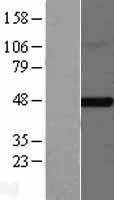 FNTB Protein - Western validation with an anti-DDK antibody * L: Control HEK293 lysate R: Over-expression lysate