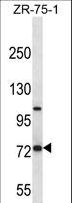 FOLH1 / PSMA Antibody - FOLH1 Antibody western blot of ZR-75-1 cell line lysates (35 ug/lane). The FOLH1 antibody detected the FOLH1 protein (arrow).