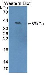 FOLH1 / PSMA Antibody - Western blot of FOLH1 / PSMA antibody.