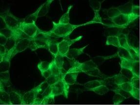FOLH1 / PSMA Antibody - Immunofluorescent staining of LNCaP cells