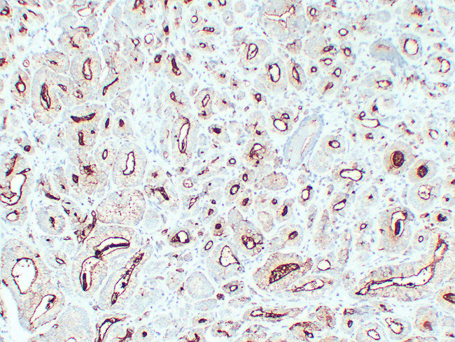 FOLH1 / PSMA Antibody - Prostatic Carcinoma 1