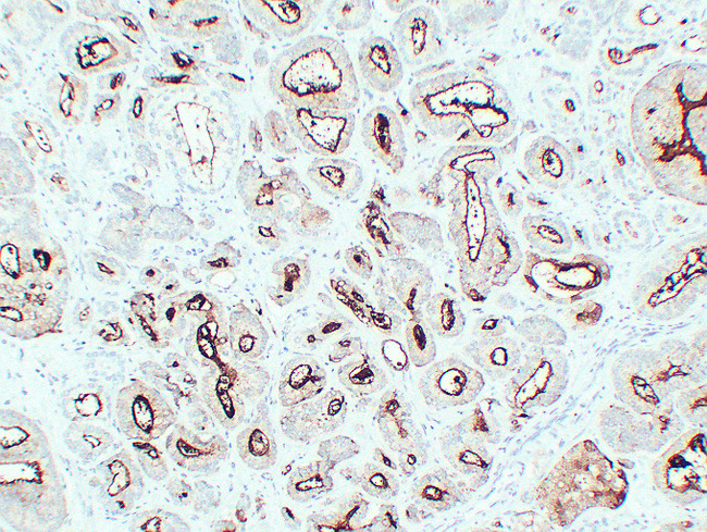 FOLH1 / PSMA Antibody - Prostatic Carcinoma 2
