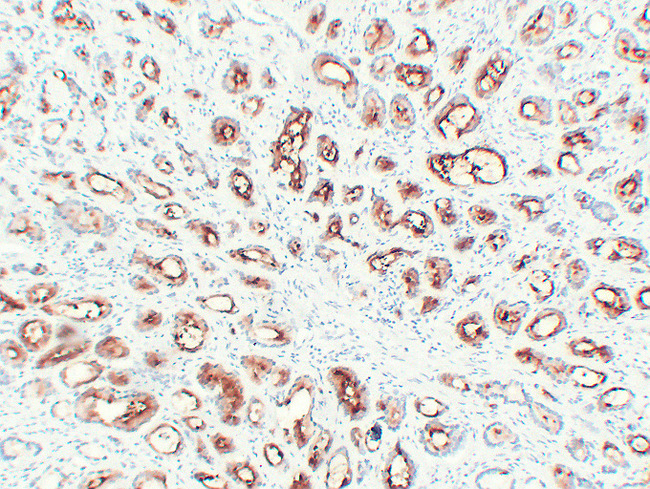 FOLH1 / PSMA Antibody - Prostatic Carcinoma 3