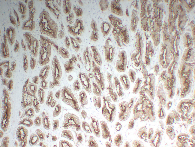 FOLH1 / PSMA Antibody - Prostatic Carcinoma 5