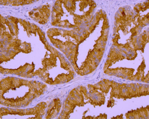 FOLH1 / PSMA Antibody - Immunohistochemistry of GCPII in human prostate by GCP-04 monoclonal antibody. Mag. 400x; positive epithelium of the prostate glands.