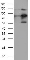 FOLH1 / PSMA Antibody - HEK293T cells were transfected with the pCMV6-ENTRY control (Left lane) or pCMV6-ENTRY FOLH1 (Right lane) cDNA for 48 hrs and lysed. Equivalent amounts of cell lysates (5 ug per lane) were separated by SDS-PAGE and immunoblotted with anti-FOLH1.