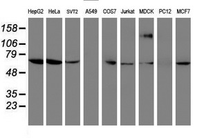FOLH1 / PSMA Antibody - Western blot of extracts (35 ug) from 9 different cell lines by using anti-FOLH1 monoclonal antibody.