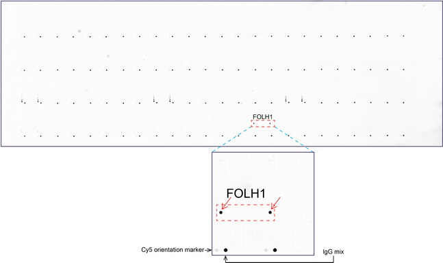 FOLH1 / PSMA Antibody - OriGene overexpression protein microarray chip was immunostained with UltraMAB anti-FOLH1 mouse monoclonal antibody. (Clone UMAB25). The positive reactive proteins are highlighted with two red arrows in the enlarged subarray. All the positive controls spotted in this subarray are also labeled for clarification. These data show that UltraMAB anti-FOLH1. (Clone UMAB25) very specifically recognizes FOLH1 antigen on OriGene protein microarray chip.