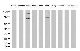 FOLH1 / PSMA Antibody - Western Blot analysis of 10 different human tissue lysates. (10ug) by using anti-FOLH1 monoclonal antibody. (clone UMAB25, 1:500)