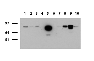 FOLH1 / PSMA Antibody - Western blot of human tissue lysates. (15ug) from 10 different tissues. (1: Testis, 2: Omentum, 3: Uterus, 4: Breast, 5: Brain, 6: Thyroid, 7: Colon, 8: Spleen 9: Liver, 10: Ovary). Diluation: 1:500.