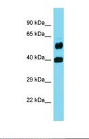 FOLH1B Antibody - Western blot of Fetal Brain. FOLH1B antibody dilution 1.0 ug/ml.  This image was taken for the unconjugated form of this product. Other forms have not been tested.