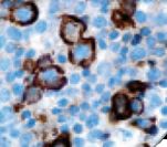 Follicular Dendritic Cells Antibody - IHC of FDC on FFPE Tonsil tissue. This image was taken for the unmodified form of this product. Other forms have not been tested.