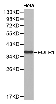 Anti-FOLR1 / Folate Receptor Alpha Antibody | Rabbit anti-Human | LSBio