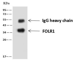 FOLR1 / Folate Receptor Alpha Antibody - FOLR1 was immunoprecipitated using: Lane A: 0.5 mg HeLa Whole Cell Lysate. 4 uL anti-FOLR1 rabbit polyclonal antibody and 60 ug of Immunomagnetic beads Protein A/G. Primary antibody: Anti-FOLR1 rabbit polyclonal antibody, at 1:100 dilution. Secondary antibody: Goat Anti-Rabbit IgG (H+L)/HRP at 1/10000 dilution. Developed using the ECL technique. Performed under reducing conditions. Predicted band size: 35 kDa. Observed band size: 35 kDa.