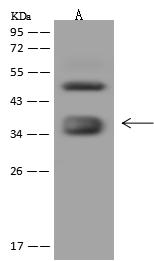 FOLR1 / Folate Receptor Alpha Antibody - nti-FOLR1 rabbit polyclonal antibody at 1:500 dilution. Lane A: HeLa Whole Cell Lysate. Lysates/proteins at 30 ug per lane. Secondary: Goat Anti-Rabbit IgG (H+L)/HRP at 1/10000 dilution. Developed using the ECL technique. Performed under reducing conditions. Predicted band size: 30 kDa. Observed band size: 37 kDa.