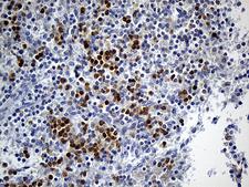FOLR3 Antibody - Immunohistochemical staining of paraffin-embedded Human spleen tissue within the normal limits using anti-FOLR3 mouse monoclonal antibody. (Heat-induced epitope retrieval by 1mM EDTA in 10mM Tris buffer. (pH8.5) at 120°C for 3 min. (1:150)