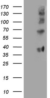 FOLR3 Antibody - HEK293T cells were transfected with the pCMV6-ENTRY control. (Left lane) or pCMV6-ENTRY FOLR3. (Right lane) cDNA for 48 hrs and lysed. Equivalent amounts of cell lysates. (5 ug per lane) were separated by SDS-PAGE and immunoblotted with anti-FOLR3. (1:2000)