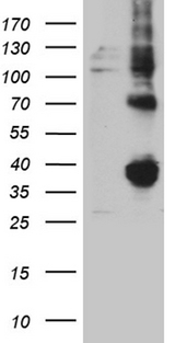 FOLR3 Antibody - HEK293T cells were transfected with the pCMV6-ENTRY control. (Left lane) or pCMV6-ENTRY FOLR3. (Right lane) cDNA for 48 hrs and lysed. Equivalent amounts of cell lysates. (5 ug per lane) were separated by SDS-PAGE and immunoblotted with anti-FOLR3. (1:2000)