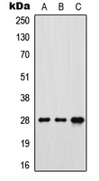 FOLR3 Antibody - Western blot analysis of FR gamma expression in MCF7 (A); SP2/0 (B); rat brain (C) whole cell lysates.