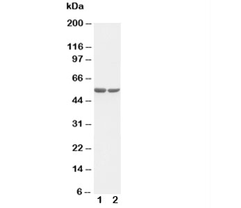 FOS / c-FOS Antibody - Western blot testing of c-Fos antibody and Lane 1: HT1080; 2: COLO320 cell lysate