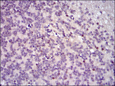 FOS / c-FOS Antibody - IHC of paraffin-embedded cerebellum tissues using FOS mouse monoclonal antibody with DAB staining.