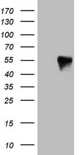 FOS / c-FOS Antibody - HEK293T cells were transfected with the pCMV6-ENTRY control. (Left lane) or pCMV6-ENTRY FOS. (Right lane) cDNA for 48 hrs and lysed. Equivalent amounts of cell lysates. (5 ug per lane) were separated by SDS-PAGE and immunoblotted with anti-FOS. (1:2000)