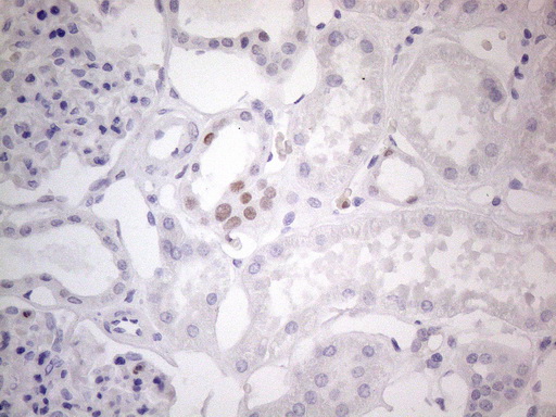 FOS / c-FOS Antibody - Immunohistochemical staining of paraffin-embedded Human Kidney tissue within the normal limits using anti-FOS mouse monoclonal antibody. (Heat-induced epitope retrieval by 1mM EDTA in 10mM Tris buffer. (pH8.5) at 120°C for 3 min. (1:150)(1:200)