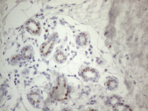 FOS / c-FOS Antibody - Immunohistochemical staining of paraffin-embedded Human breast tissue within the normal limits using anti-FOS mouse monoclonal antibody. (Heat-induced epitope retrieval by 1mM EDTA in 10mM Tris buffer. (pH8.5) at 120°C for 3 min. (1:150)(1:200)