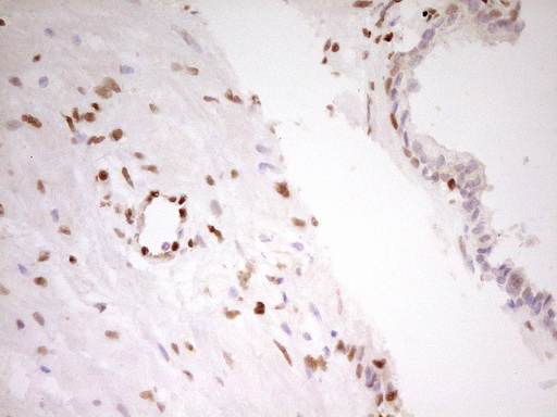 FOS / c-FOS Antibody - Immunohistochemical staining of paraffin-embedded Human prostate tissue within the normal limits using anti-FOS mouse monoclonal antibody. (Heat-induced epitope retrieval by 1 mM EDTA in 10mM Tris, pH8.5, 120C for 3min,