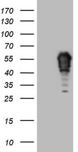 FOS / c-FOS Antibody - HEK293T cells were transfected with the pCMV6-ENTRY control. (Left lane) or pCMV6-ENTRY FOS. (Right lane) cDNA for 48 hrs and lysed. Equivalent amounts of cell lysates. (5 ug per lane) were separated by SDS-PAGE and immunoblotted with anti-FOS.