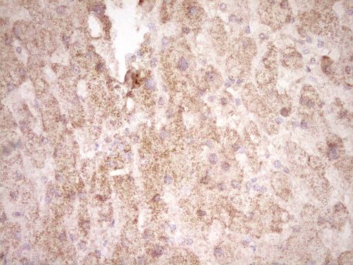 FOS / c-FOS Antibody - Immunohistochemical staining of paraffin-embedded Human liver tissue within the normal limits using anti-FOS mouse monoclonal antibody. (Heat-induced epitope retrieval by 1 mM EDTA in 10mM Tris, pH8.5, 120C for 3min,