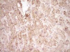 FOS / c-FOS Antibody - IHC of paraffin-embedded Human liver tissue using anti-FOS mouse monoclonal antibody. (Heat-induced epitope retrieval by 1 mM EDTA in 10mM Tris, pH8.5, 120°C for 3min).