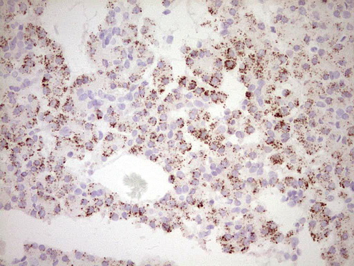 FOS / c-FOS Antibody - Immunohistochemical staining of paraffin-embedded Human pancreas tissue within the normal limits using anti-FOS mouse monoclonal antibody. (Heat-induced epitope retrieval by 1 mM EDTA in 10mM Tris, pH8.5, 120C for 3min,