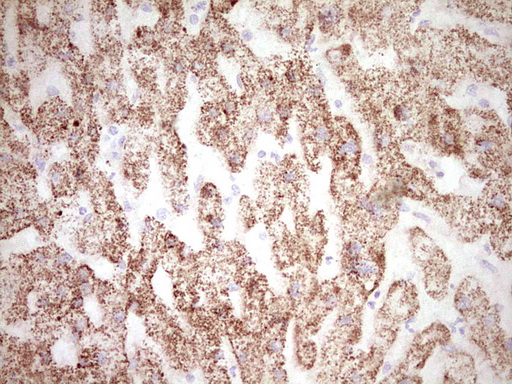 FOS / c-FOS Antibody - IHC of paraffin-embedded Human liver tissue using anti-FOS mouse monoclonal antibody. (Heat-induced epitope retrieval by 1 mM EDTA in 10mM Tris, pH8.5, 120°C for 3min).