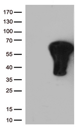 FOS / c-FOS Antibody - HEK293T cells were transfected with the pCMV6-ENTRY control. (Left lane) or pCMV6-ENTRY FOS. (Right lane) cDNA for 48 hrs and lysed. Equivalent amounts of cell lysates. (5 ug per lane) were separated by SDS-PAGE and immunoblotted with anti-FOS. (1:4000)