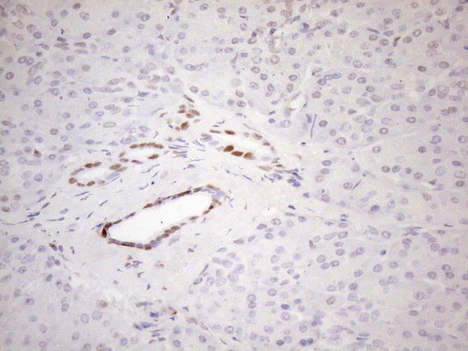 FOS / c-FOS Antibody - Immunohistochemical staining of paraffin-embedded human pancreas tissue within the normal limits using anti-FOS mouse monoclonal antibody. HIER pretreatment was done with 1mM EDTA in 10mM Tris buffer. (pH8.0) at 120°C for 2.5 minutes.was diluted 1:200 and detection was done with HRP secondary and DAB chromogen. Here we see nuclear staining.