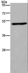 FOS / c-FOS Antibody - Western blot analysis of HeLa cell, using FOS Polyclonal Antibody at dilution of 1:400.