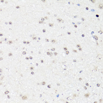FOS / c-FOS Antibody - Immunohistochemistry of paraffin-embedded mouse brain using C-FOS antibody at dilution of 1:150 (40x lens).