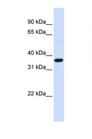 FOS / c-FOS Antibody - FOS / c-FOS antibody Western blot of Fetal Muscle lysate. Antibody concentration 1 ug/ml. This image was taken for the unconjugated form of this product. Other forms have not been tested.